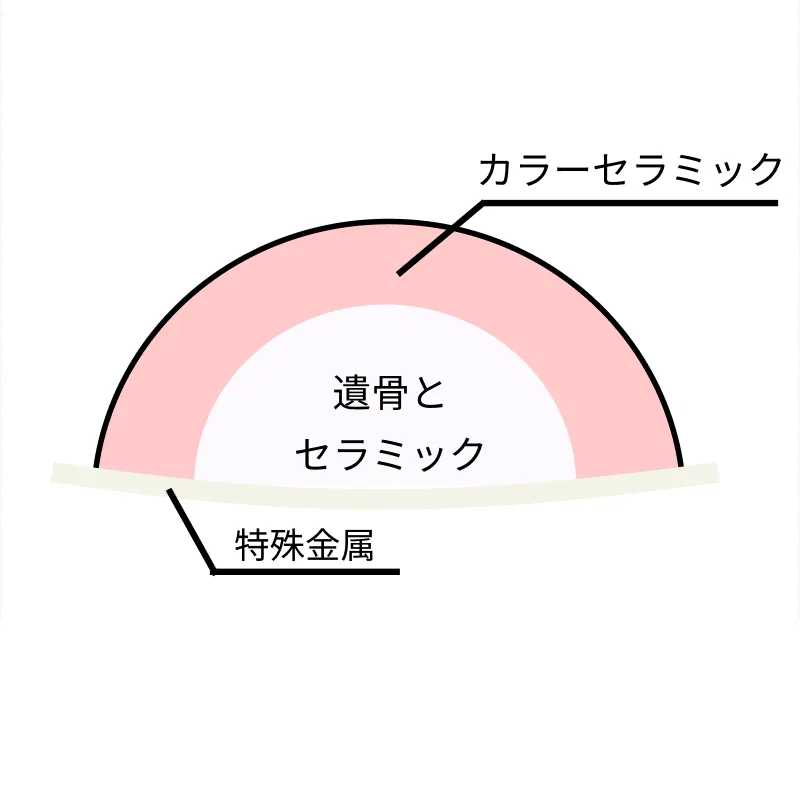 ご遺骨をセラミックで包む工程の図解